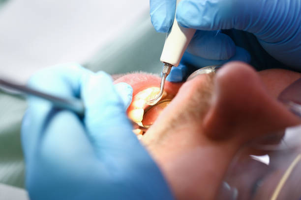 Best Broken or Chipped Tooth Repair in Ballard, UT